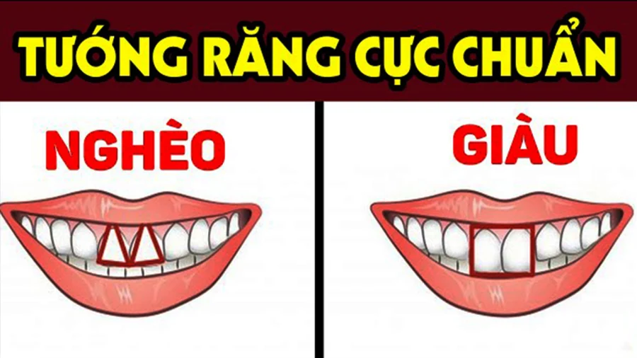 Nhìn tướng răng cửa biết ngay tương lai giàu sang hay nghèo khó: Chính x.ác hơn nhìn m.ặt