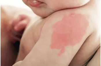 Đứa trẻ nào khi s.inh ra hầu như đều có bớt trên người, nhưng nếu xuất hiện ở 10 vị trí sau b.áo hiệu s.ố kiếp giàu sang