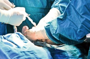 Bé trai 1 ngày tuổi không qua khỏi vì mẹ chọn sinh chủ động ở tuần 36